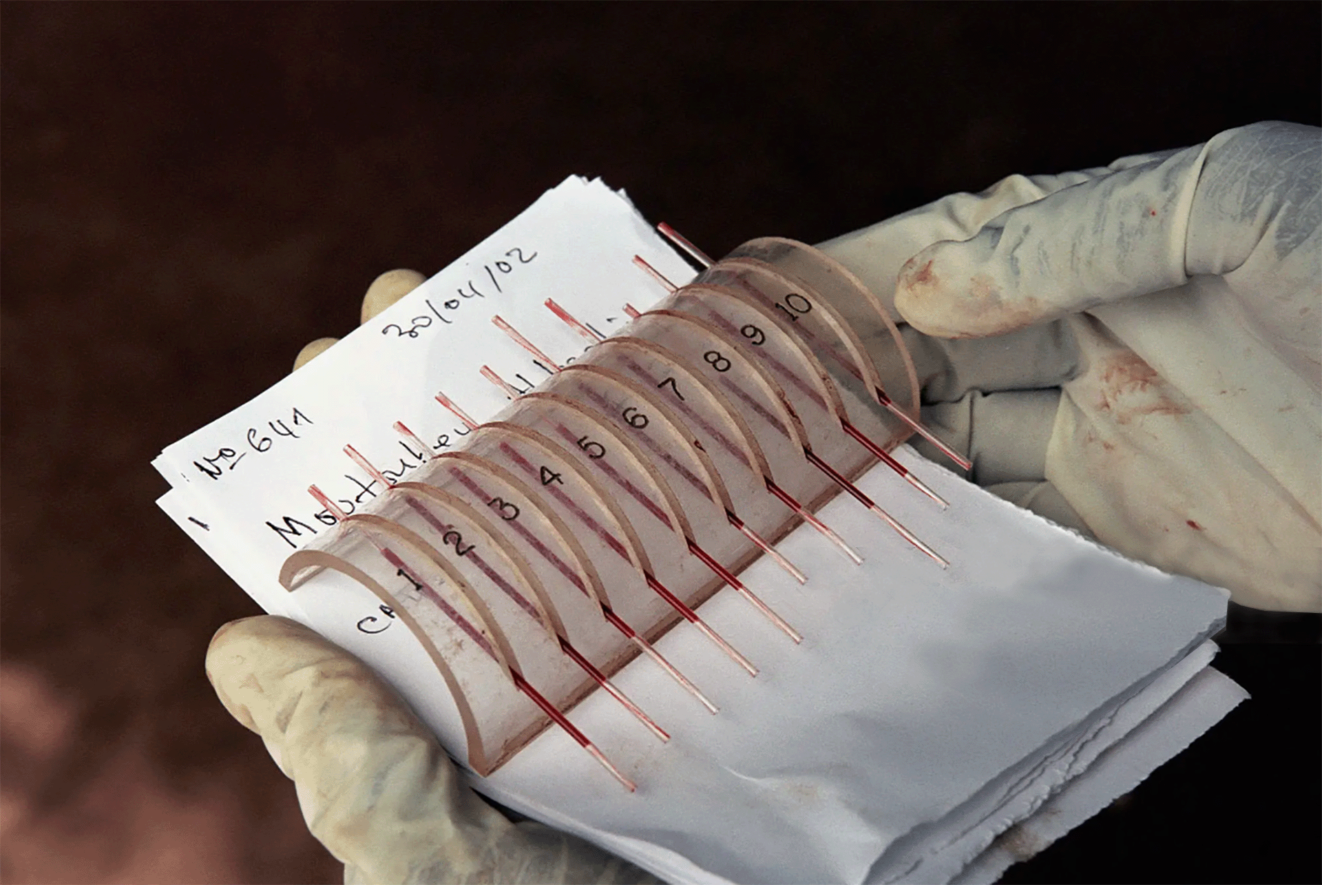 Medical screening campaign for sleeping sickness in Chad