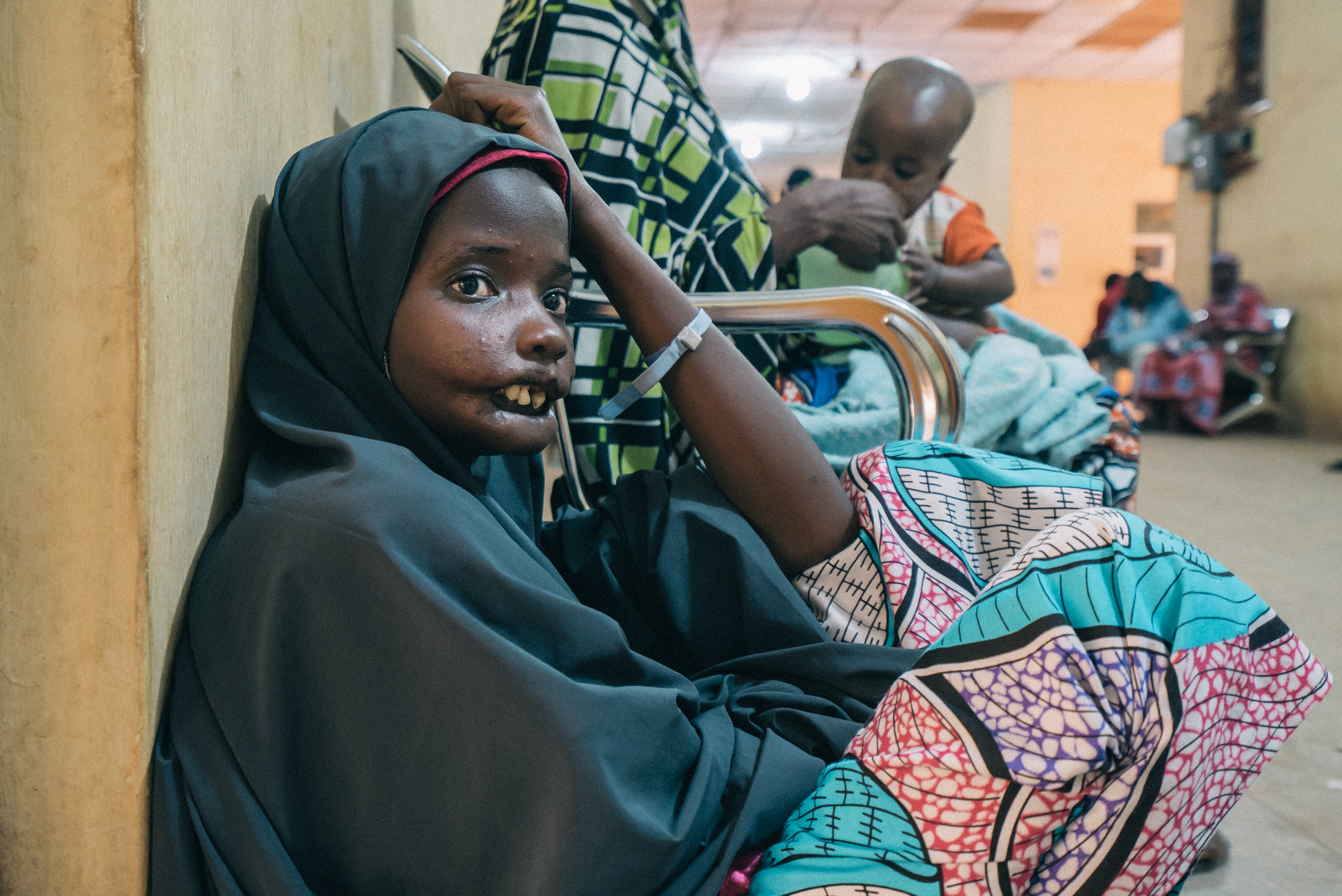 Amina, a 19-year-old noma patient from Yobe state, waits for the screening session at Noma Hospital in Sokoto. Amina came several times since her first visit in November 2016. Nigeria, on October 2017.